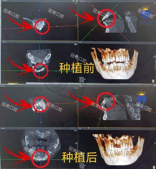 在上海鼎植口腔医院就诊的总体感受如何？