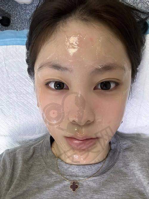 深圳罗文整形医院光子嫩肤的成效如何？值得去吗？