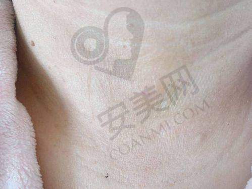总结：北京广济疤痕医院值得选择吗？综合评价与建议