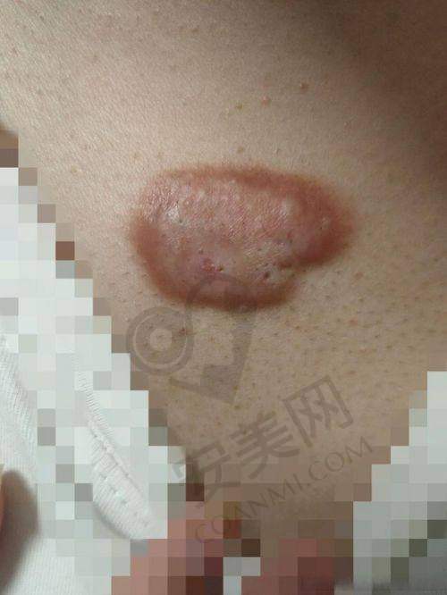 刘霞医生：专精技术的代表