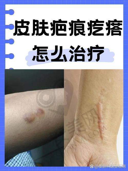 北京广济疤痕医院的口碑在患者群体中究竟怎样？