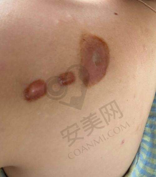 实地探访：北京广济疤痕医院的服务质量究竟如何？