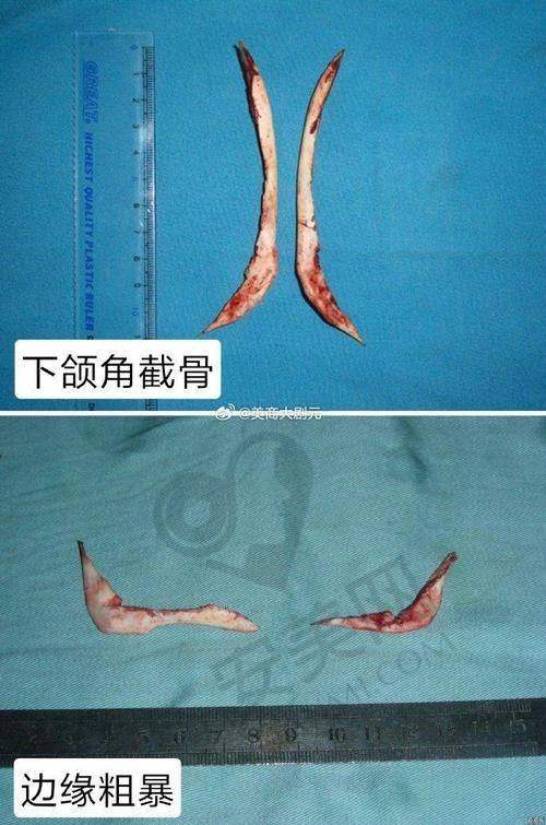 多样化的预约方式