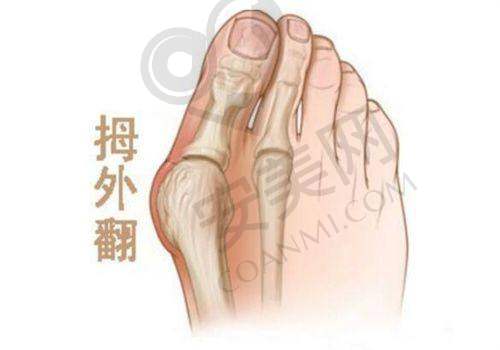 长沙梵童陈仕文超模直腿术的优势有哪些