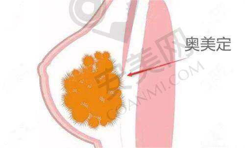 精致轻薄脸：美的新潮流