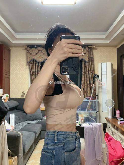 广州美莱宋新自体脂肪丰胸价格分阶解析