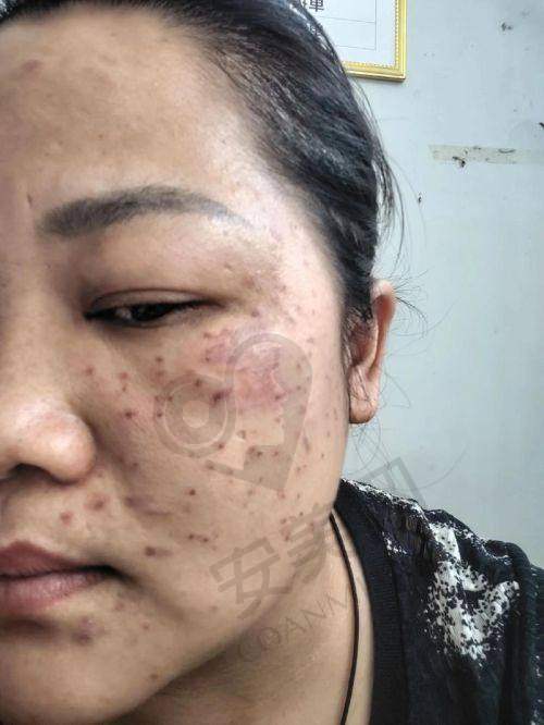 治疗后的成效和感受如何？