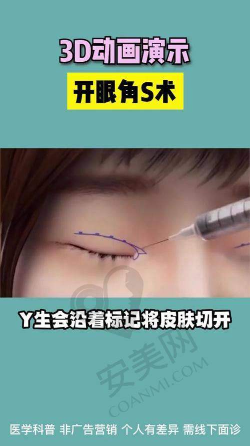 内眼角修复价格为何是15000元起？