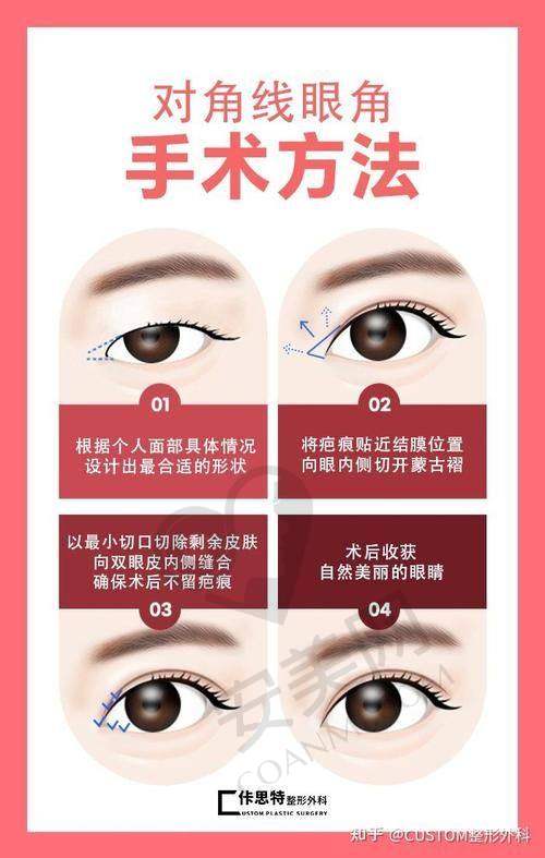 内眼角修复手术的过程是怎样的？