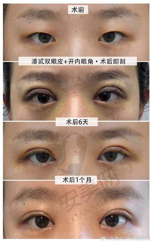 总结