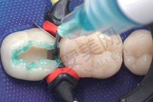 乌鲁木齐优佳贝口腔的口碑如何？