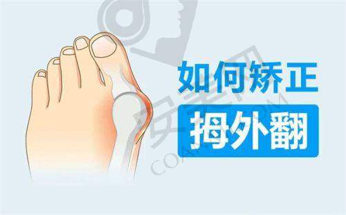 北京马文足科医院的拇外翻手术实例成效如何？