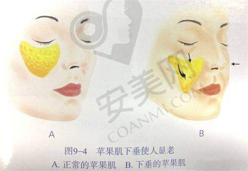 合肥维多利亚半岛超声炮值得尝试吗？