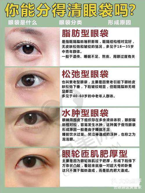 深圳祛眼袋医生推荐