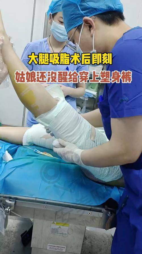 广州军美大腿吸脂项目有哪些优势？