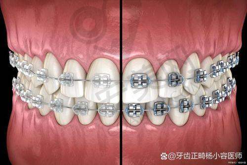 北京口腔医院的正畸能手