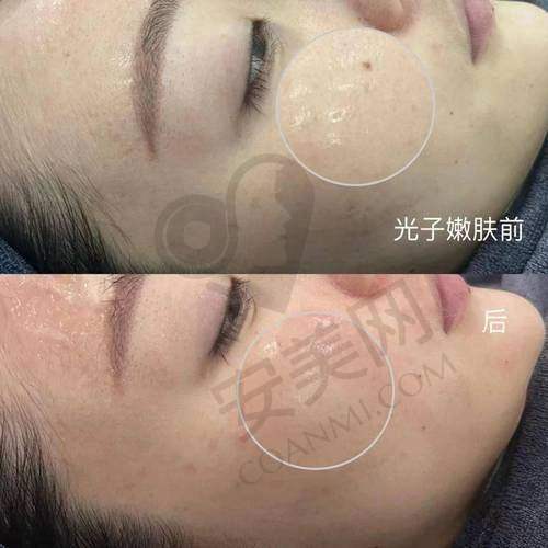 吉首星美整形医院的口碑怎么样？
