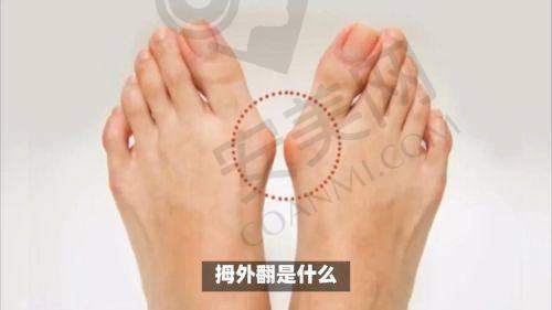 患者口碑调查：圣嘉新与马文足科谁更受认可？