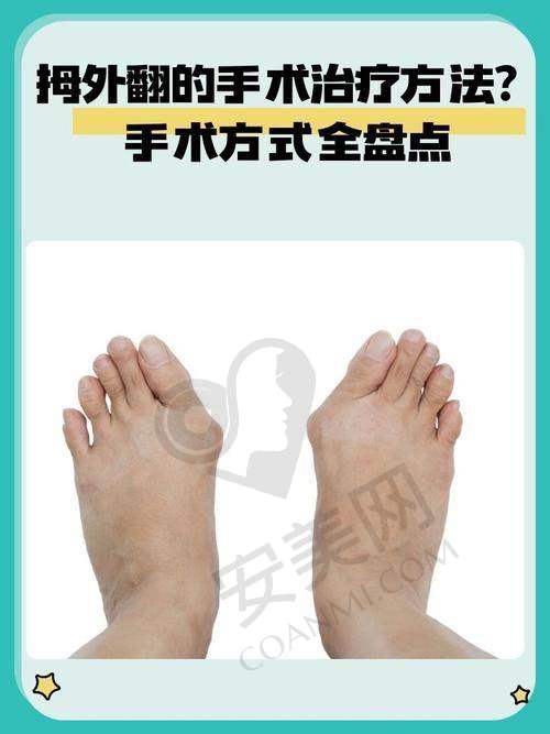 总结：圣嘉新与马文足科谁能脱颖而出？
