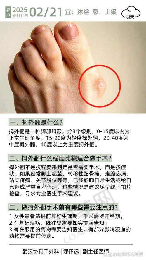 北京马文足科医院拇外翻矫正项目的治疗流程是怎样的？