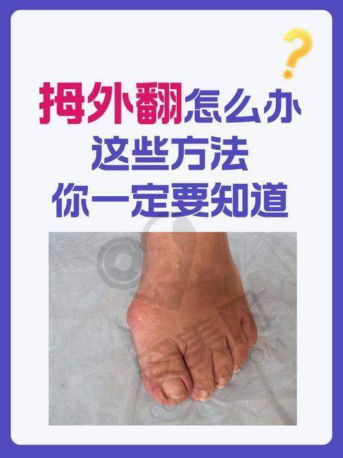 价格差异分析：圣嘉新与马文足科哪个更实惠？