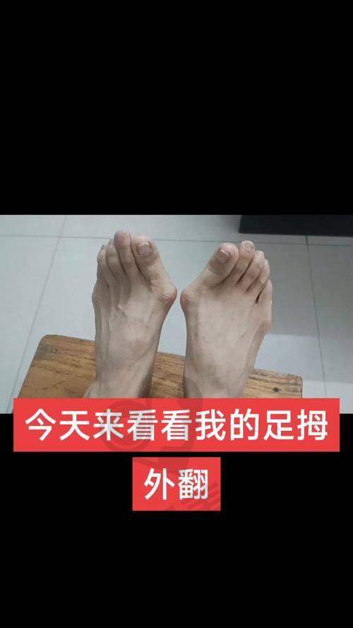 圣嘉新与马文足科的技术对比：谁更胜一筹？
