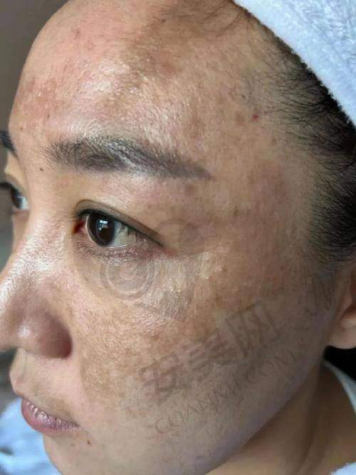 操作细节：不容忽视的要点