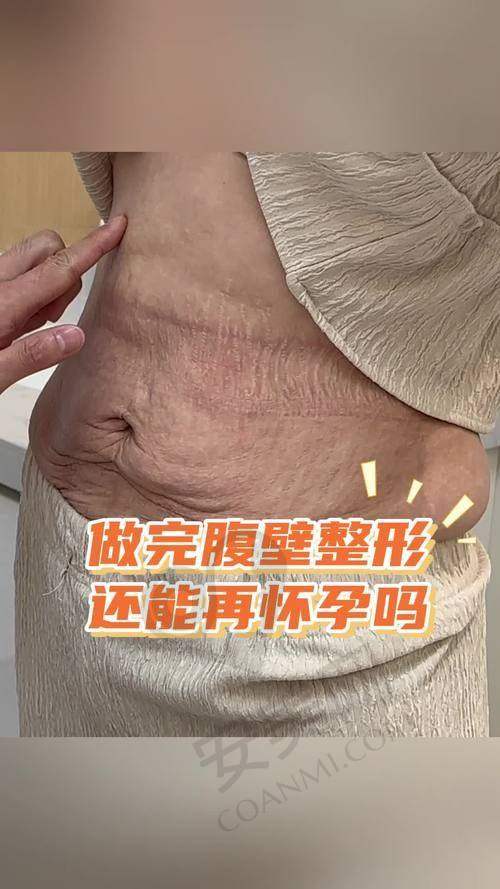 腹壁成形术的就诊过程是怎样的？