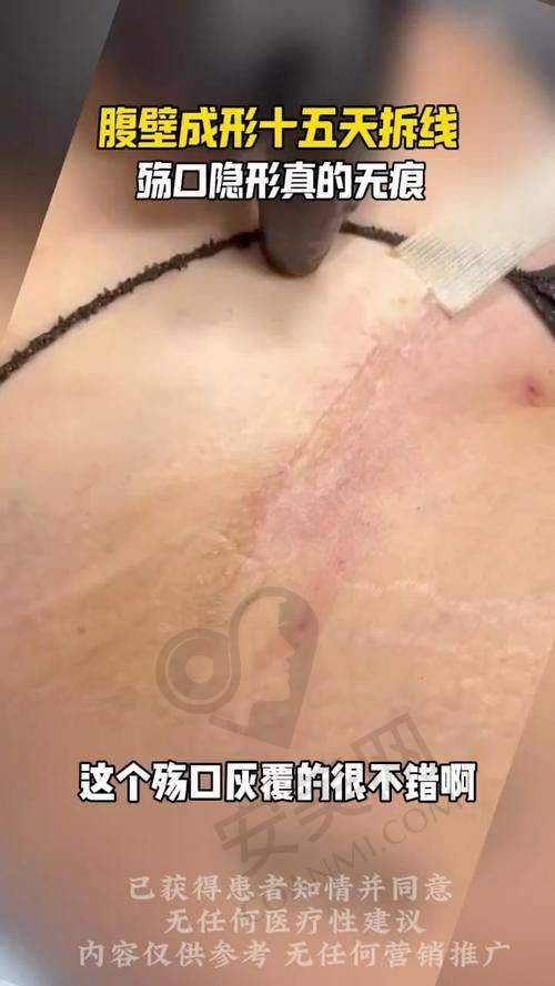 成都现代整形医院怎么样？靠谱吗？