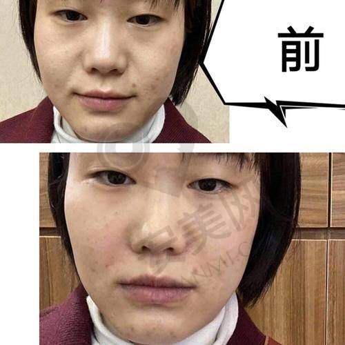 李琳医生：专精与经验的理想结合