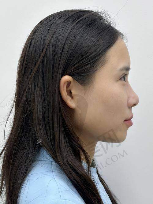 注意事项：确保治疗成效和安心