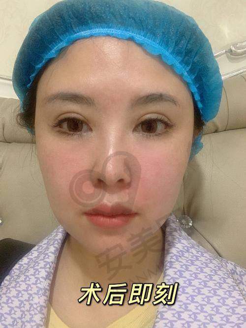 术后成效：自然、美观、持久