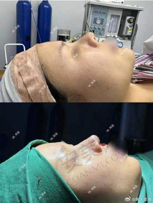 选择上海联合丽格范荣杰院长，开启美丽新生