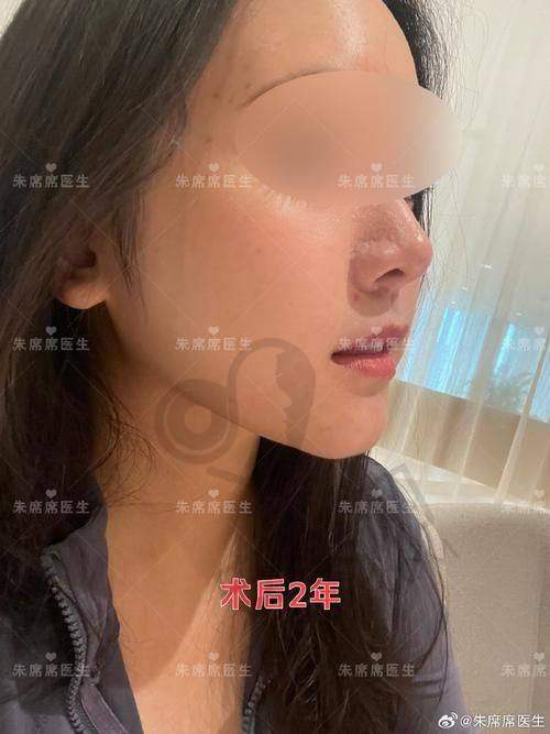 广州军美整形医院的吸脂口碑如何？