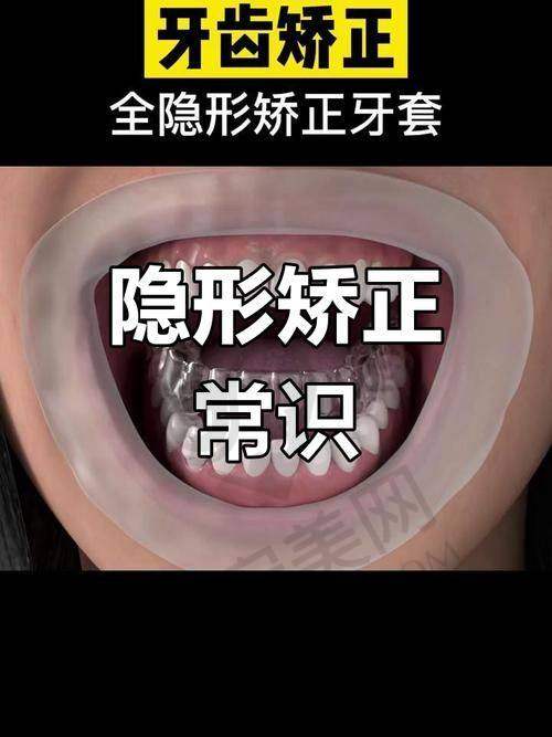 深圳新浩口腔医院的服务怎么样？