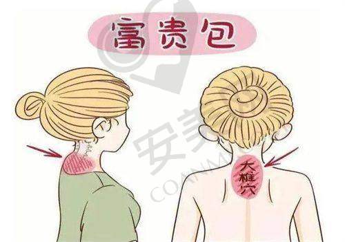 西安国医叶桐江医生擅长项目: