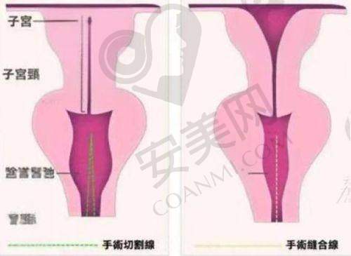特色项目：北京黄寺医疗美容中 心有哪些独特的医美项目？