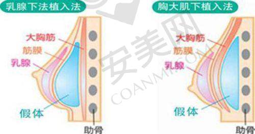 注射肉毒素除皱后需要注意什么？