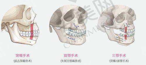 佳木斯韩艺来和美白医院背景概述