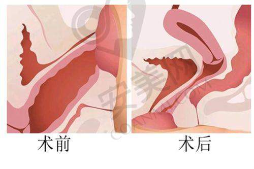 长沙雅美整形医院的交通便利吗？