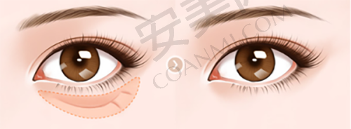 佳木斯韩艺来和美白的技术设备与治疗优势