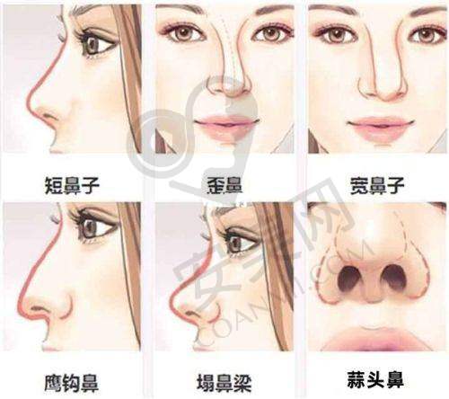 术后修复情况如何？