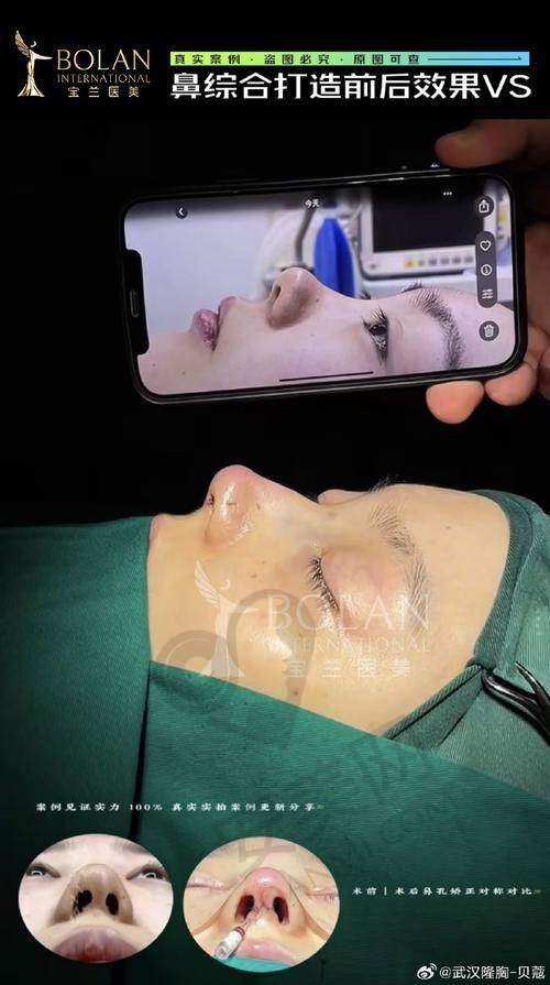范荣杰医生擅长的项目