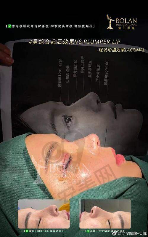 给求美者的建议