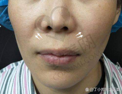 佳木斯韩艺来：专精医美机构的魅力