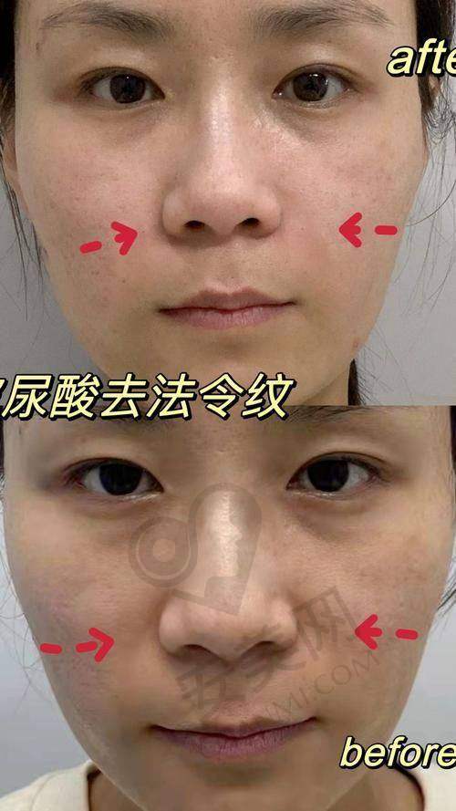 总结