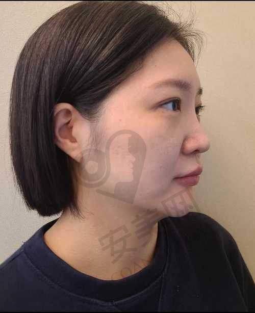 常见疑问解答