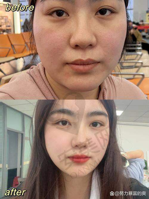 价格分阶体现：满足不同需求