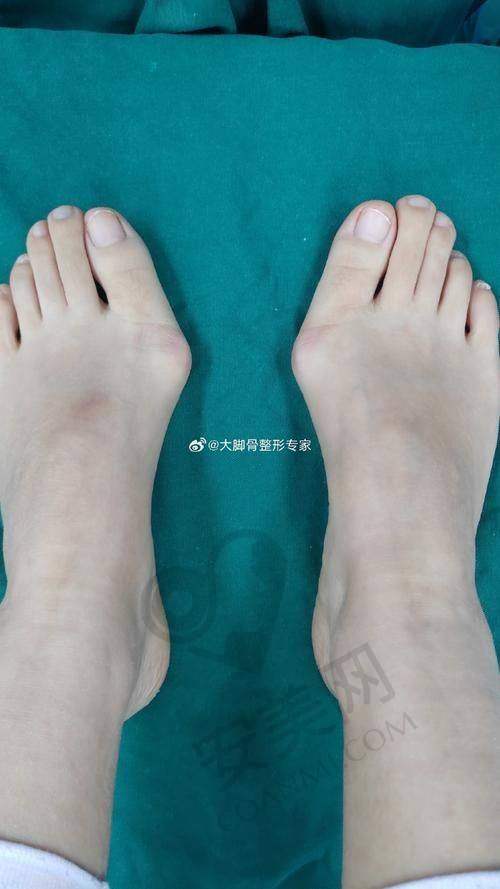 外地福音：北京圣嘉新苏敬达预约挂号攻略
