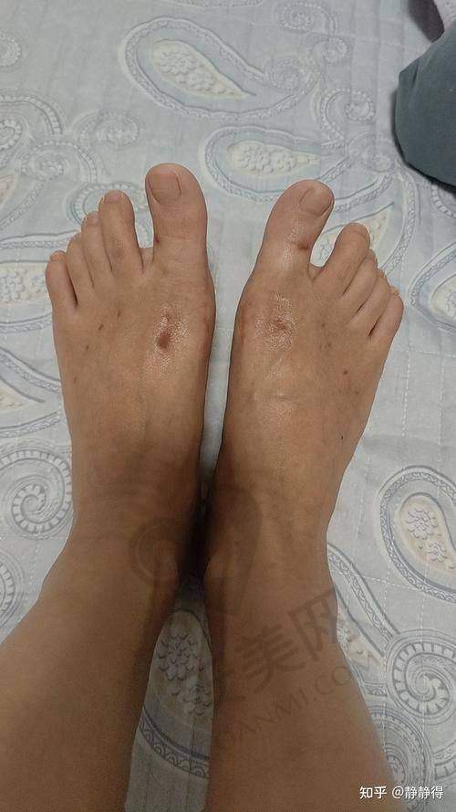 神奇成效：从绝望到重生